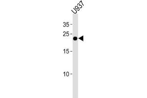 Western Blotting (WB) image for anti-Interferon, alpha 4 (IFNa4) antibody (ABIN3004650) (IFNA4 anticorps)