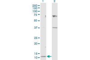 Western Blot analysis of CST3 expression in transfected 293T cell line by CST3 MaxPab polyclonal antibody. (CST3 anticorps  (AA 1-146))