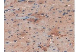 IHC-P analysis of Human Heart Tissue, with DAB staining. (Haptoglobin anticorps  (AA 70-332))