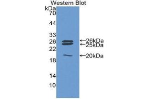 Western Blotting (WB) image for anti-Catalase (CAT) (AA 246-366) antibody (ABIN1858260) (Catalase anticorps  (AA 246-366))