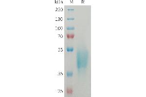 Human OSCAR Protein, His Tag on SDS-PAGE under reducing condition. (OSCAR Protein (AA 19-282) (His tag))