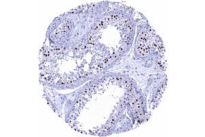 Testis Strong SOX9 staining of Sertoli cells (Recombinant SOX9 anticorps  (AA 393-508))