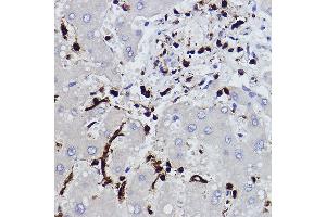 Immunohistochemistry of paraffin-embedded human liver using L-Plastin/LCP1 Rabbit mAb (ABIN7268317) at dilution of 1:100 (40x lens). (LCP1 anticorps)