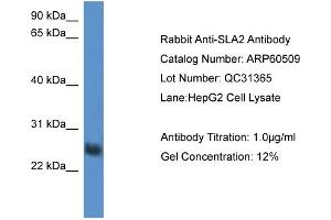 WB Suggested Anti-SLA2  Antibody Titration: 0. (SLAP2 anticorps  (Middle Region))