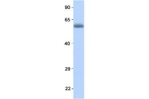 Host:  Rabbit  Target Name:  RELA  Sample Type:  Human Fetal Lung  Antibody Dilution:  1. (NF-kB p65 anticorps  (N-Term))