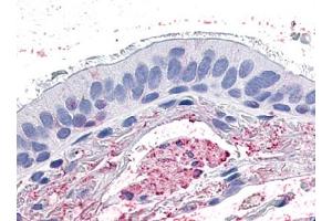 Immunohistochemical staining of Lung (Respiratory Epithelium) using anti- GPR4 antibody ABIN122484 (GPR19 anticorps)