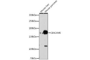 Western blot analysis of extracts of various cell lines, using CEACAM5 antibody (ABIN6291892) at 1:1000 dilution. (CEACAM5 anticorps)