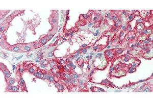 Immunohistochemistry of paraffin-embedded Kidney tissue using CD151 Polyclonal Antibody at dilution of 1:120. (CD151 anticorps)