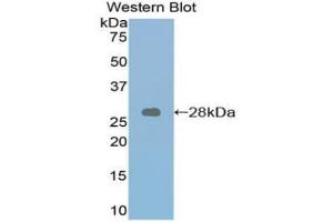 Western blot analysis of the recombinant protein. (Retinoic Acid Receptor alpha anticorps  (AA 237-459))