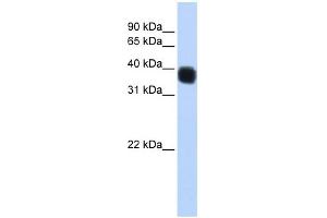 WB Suggested Anti-SSBP3 Antibody Titration: 0. (SSBP3 anticorps  (Middle Region))