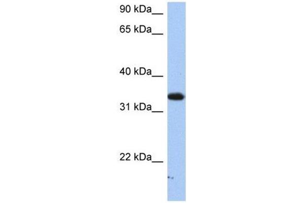 SULT6B1 anticorps  (C-Term)