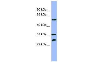 WB Suggested Anti-PSMC4 Antibody Titration: 0. (PSMC4 anticorps  (N-Term))