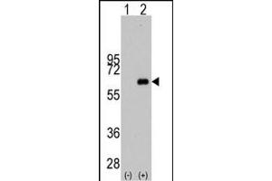 Western blot analysis of MYC (arrow) using rabbit polyclonal MYC Antibody  (ABIN388720 and ABIN2838829). (c-MYC anticorps  (AA 351-380))