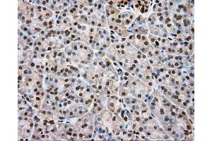 Immunohistochemical staining of paraffin-embedded lung tissue using anti-DAPK2 mouse monoclonal antibody. (DAPK2 anticorps)