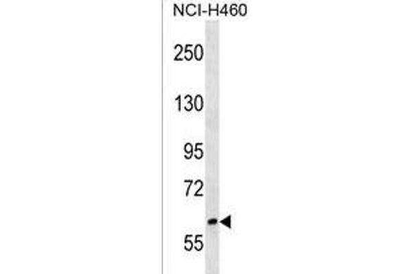 RREB1 anticorps  (C-Term)