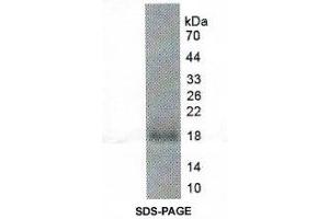 Western Blotting (WB) image for Hemicentin 1 (HMCN1) protein (ABIN6019399) (HMCN1 Protéine)