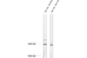 dilution: 1 : 200, sample: crude synaptosomal fraction of rat brain (P2) (Synaptojanin 1 anticorps  (Isoform 2))