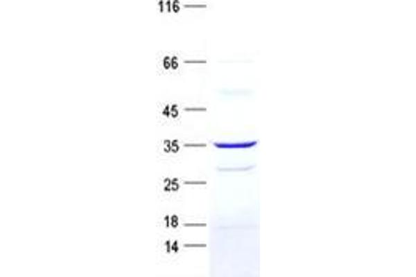 NMES1 Protein (GST tag,His tag)