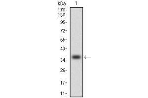 Western Blotting (WB) image for anti-Chemokine (C-C Motif) Ligand 2 (CCL2) antibody (ABIN969505)