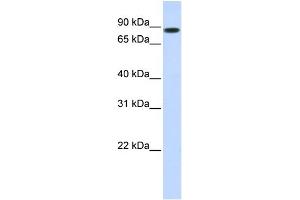 WB Suggested Anti-STAT5B Antibody Titration: 1 ug/ml Positive Control: 293T cells lysate There is BioGPS gene expression data showing that STAT5B is expressed in HEK293T (STAT5B anticorps  (N-Term))