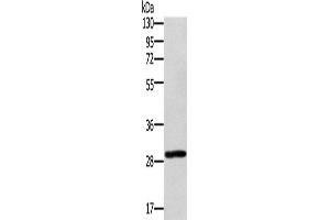 Western Blotting (WB) image for anti-Ectodysplasin A2 Receptor (EDA2R) antibody (ABIN2423351) (Ectodysplasin A2 Receptor anticorps)