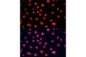 Immunofluorescence analysis of C6 cells using SOX2 Polyclonal Antibody (ABIN6130648, ABIN6148295, ABIN6148297 and ABIN6215241) at dilution of 1:100 (40x lens). (SOX2 anticorps  (AA 1-140))