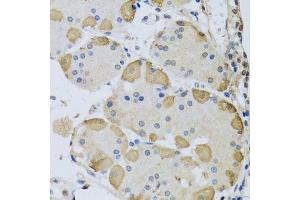 Immunohistochemistry of paraffin-embedded human stomach using ANAPC10 antibody. (ANAPC10 anticorps  (AA 1-185))