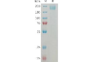 Mouse Protein, His Tag on SDS-PAGE under reducing condition. (SEZ6 Protein (AA 20-922) (His tag))