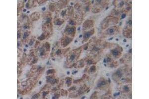 IHC-P analysis of Human Tissue, with DAB staining. (STING/TMEM173 anticorps  (AA 159-373))