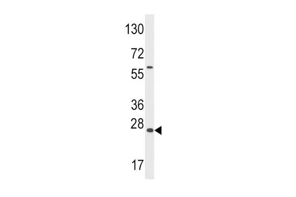 GADD45A anticorps  (N-Term)