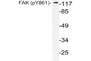Western blot (WB) analysis of p-FAK antibody in extracts from HeLa cells. (FAK anticorps  (pTyr861))