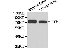 Western blot analysis of extracts of various cell lines, using TYR antibody (ABIN5970593) at 1/1000 dilution. (TYR anticorps)