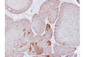 IHC-P Image Immunohistochemical analysis of paraffin-embedded Cal27 xenograft, using Proteasome 26S S3, antibody at 1:500 dilution. (Proteasome 26S S3 (Center) anticorps)