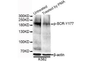 Western blot analysis of extracts of K-562 cells, using Phospho-BCR-Y177 antibody (ABIN5995631) at 1/1000 dilution. (BCR anticorps  (pTyr177))