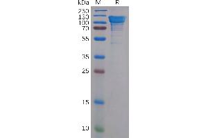 Human APP Protein, His Tag on SDS-PAGE under reducing condition. (APP Protein (AA 18-669) (His tag))