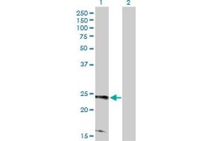Western Blot analysis of RRAS2 expression in transfected 293T cell line by RRAS2 MaxPab polyclonal antibody. (RRAS2 anticorps  (AA 1-204))