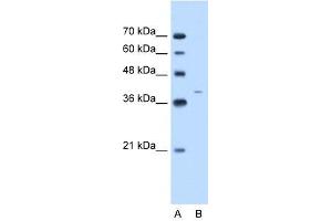 Cytokeratin 13 antibody used at 2. (Cytokeratin 13 anticorps  (C-Term))