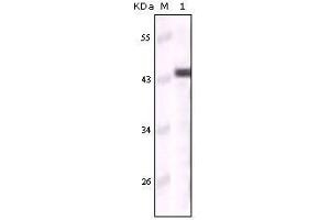 Western Blot showing CK5 antibody used against truncated CK5 recombinant protein (Cytokeratin 5 anticorps)