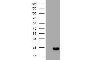 Image no. 1 for anti-Chromosome 17 Open Reading Frame 37 (C17orf37) antibody (ABIN1501782) (C17orf37 anticorps)