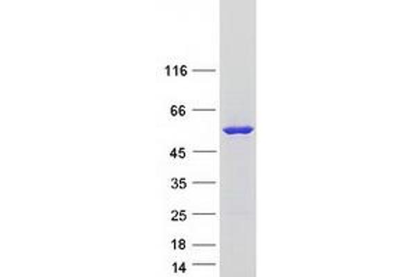 FMO3 Protein (Transcript Variant 2) (Myc-DYKDDDDK Tag)