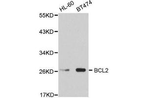 Western Blotting (WB) image for anti-B-Cell CLL/lymphoma 2 (BCL2) antibody (ABIN1876758) (Bcl-2 anticorps)