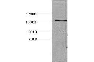 Western blot analysis of Hela, diluted at 1:1000. (COL3 anticorps)