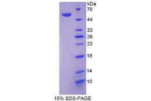 SDS-PAGE (SDS) image for Angiotensinogen (serpin Peptidase Inhibitor, Clade A, Member 8) (AGT) (AA 23-477) protein (His tag) (ABIN1078809) (AGT Protein (AA 23-477) (His tag))