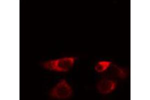 ABIN6274576 staining HeLa cells by IF/ICC. (Serotonin Receptor 5A anticorps  (Internal Region))