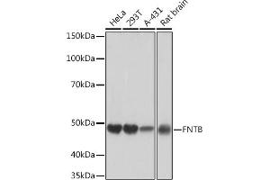 Western blot analysis of extracts of various cell lines, using FNTB Rabbit mAb (ABIN1680761, ABIN3016316, ABIN3016317 and ABIN7101479) at 1:1000 dilution. (FNTB anticorps)