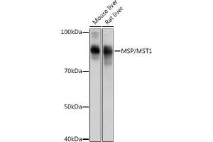 Western blot analysis of extracts of various cell lines, using MSP/MST1 Rabbit mAb (ABIN1680891, ABIN1680890, ABIN3015057 and ABIN3015058) at 1:1000 dilution. (MST1 anticorps)