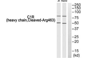 Western blot analysis of extracts from Jurkat cells and HepG2 cells, using C1R (heavy chain, Cleaved-Arg463) antibody. (C1R anticorps  (Cleaved-Arg463, Heavy Chain))