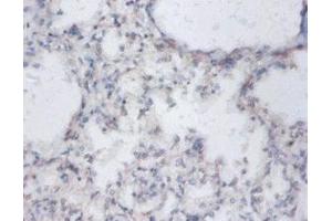 Immunohistochemistry of paraffin-embedded human lung tissue using ABIN7149863 at dilution of 1:100 (SAT1 anticorps  (AA 5-171))
