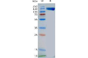 Human Protein, mFc Tag on SDS-PAGE under reducing condition. (TLR3 Protein (AA 28-80) (mFc Tag))