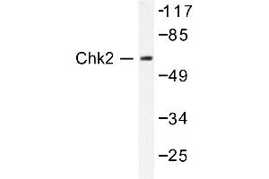 Image no. 1 for anti-Checkpoint Kinase 2 (CHEK2) antibody (ABIN271879) (CHEK2 anticorps)